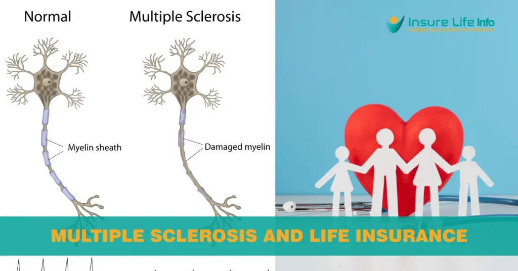 Multiple Sclerosis and Life Insurance